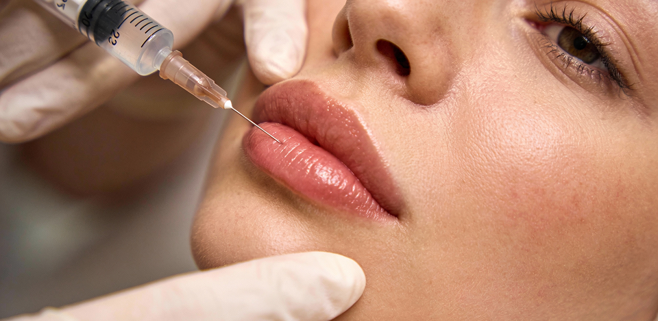 What Are Dermal Fillers?