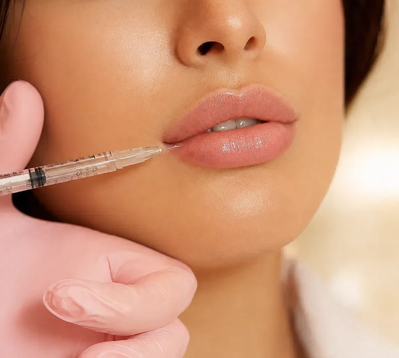 What Are Dermal Fillers?