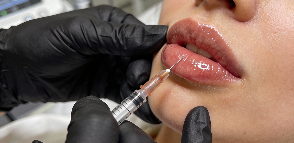 Injection Technique and Filler Placement