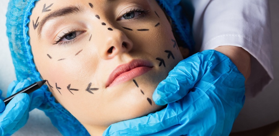 Facial Asymmetry