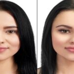 Juvéderm Versus Restylane: Which Filler Is Right for You