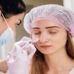 Botox for Bunny Lines: Benefits, Results, and What to Expect