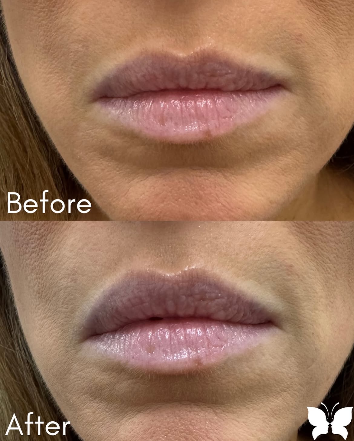 Before and after treatment photo 1