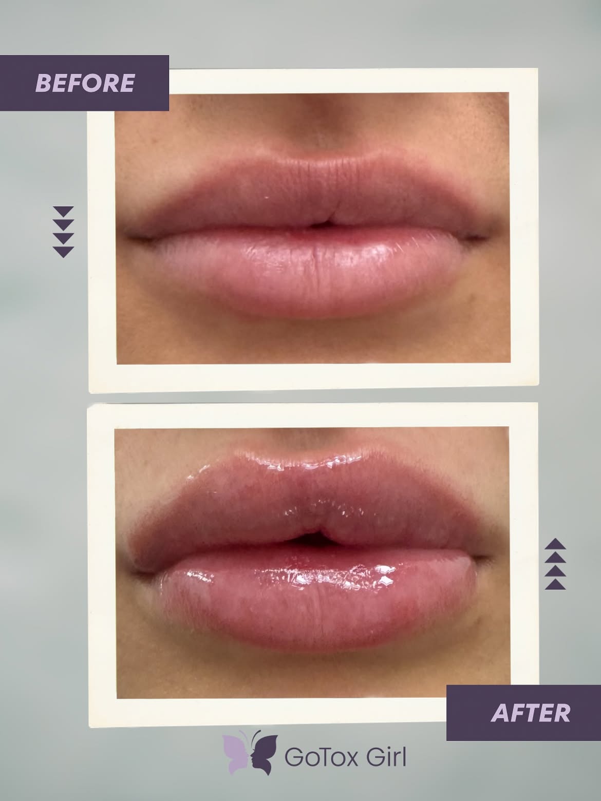 Before and after treatment photo 2
