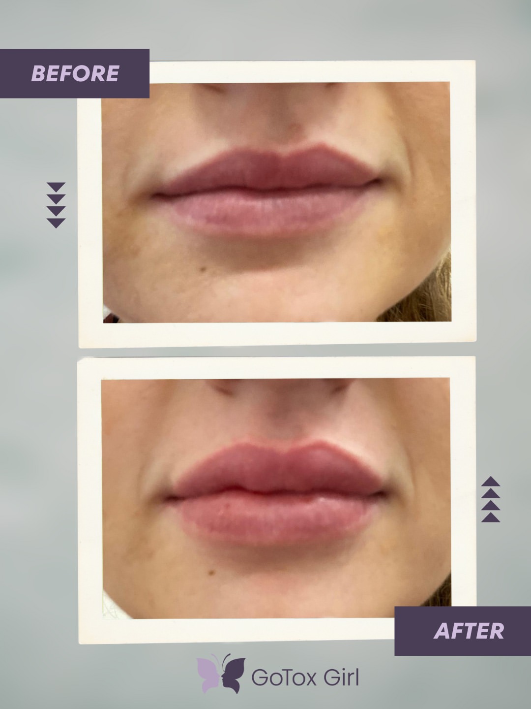 Before and after treatment photo 4