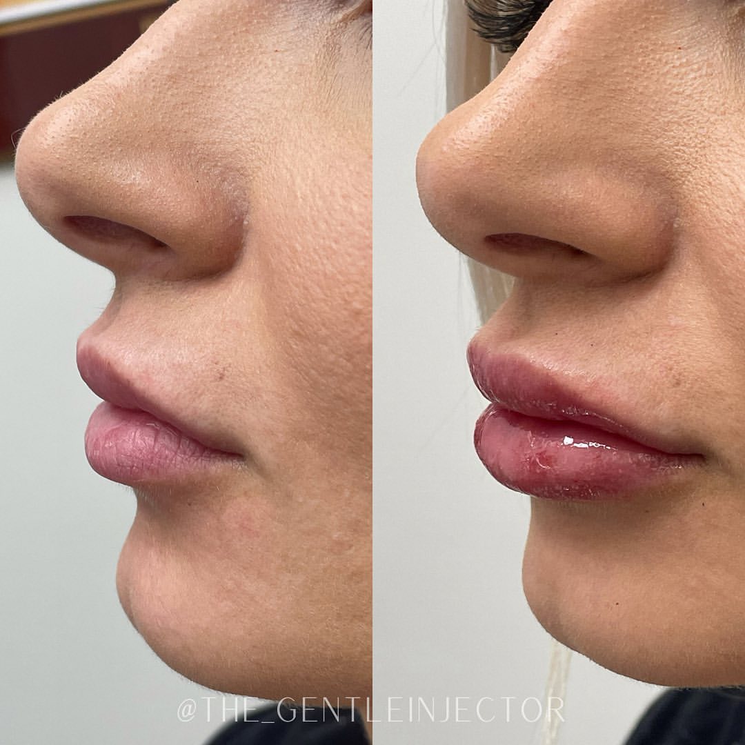 Before and after treatment photo 6
