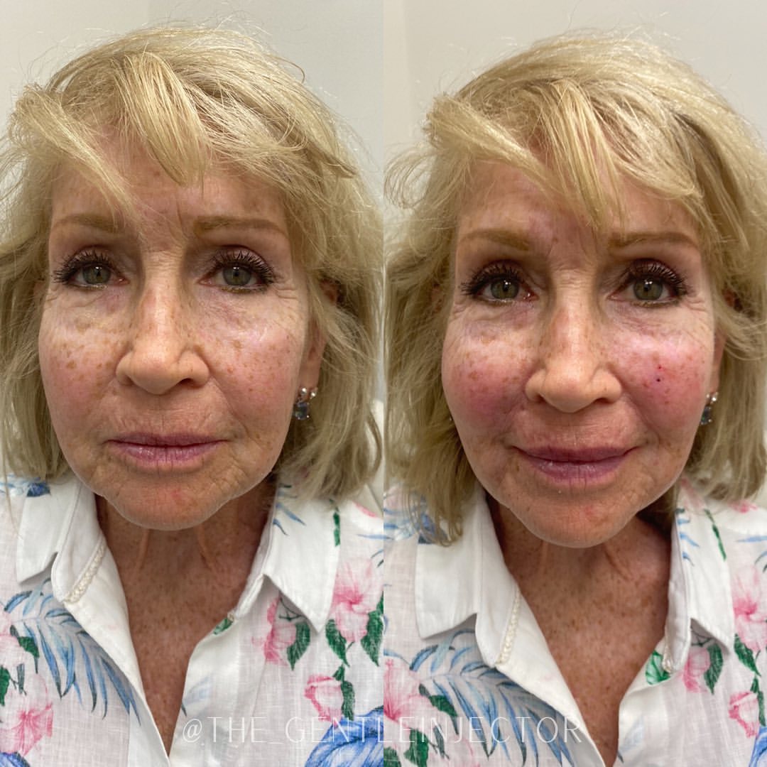 Before and after treatment photo 7