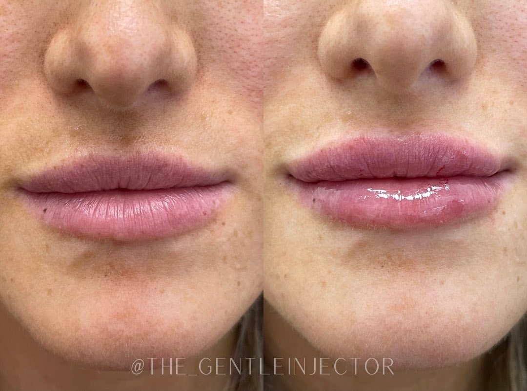 Before and after treatment photo 8