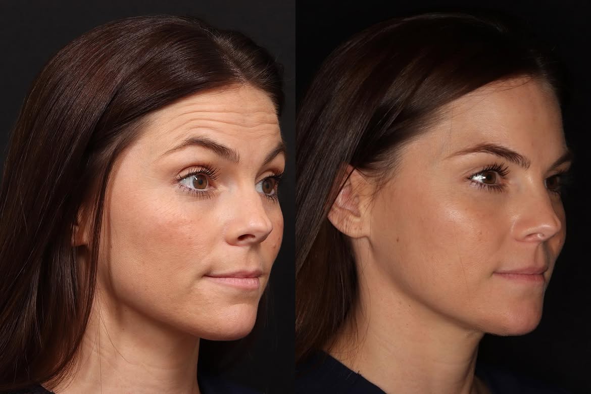 Before and after treatment photo 10