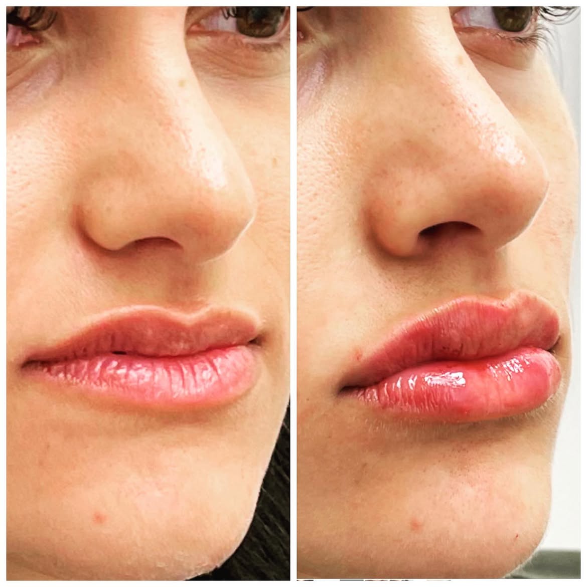 Before and after treatment photo 11