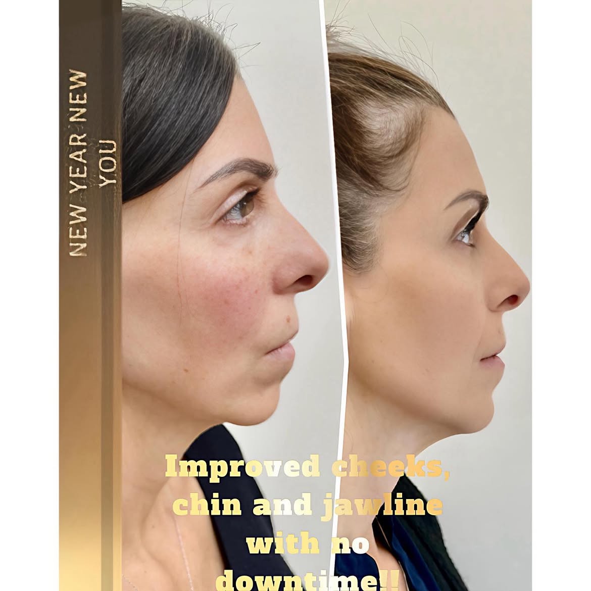 Before and after treatment photo 12