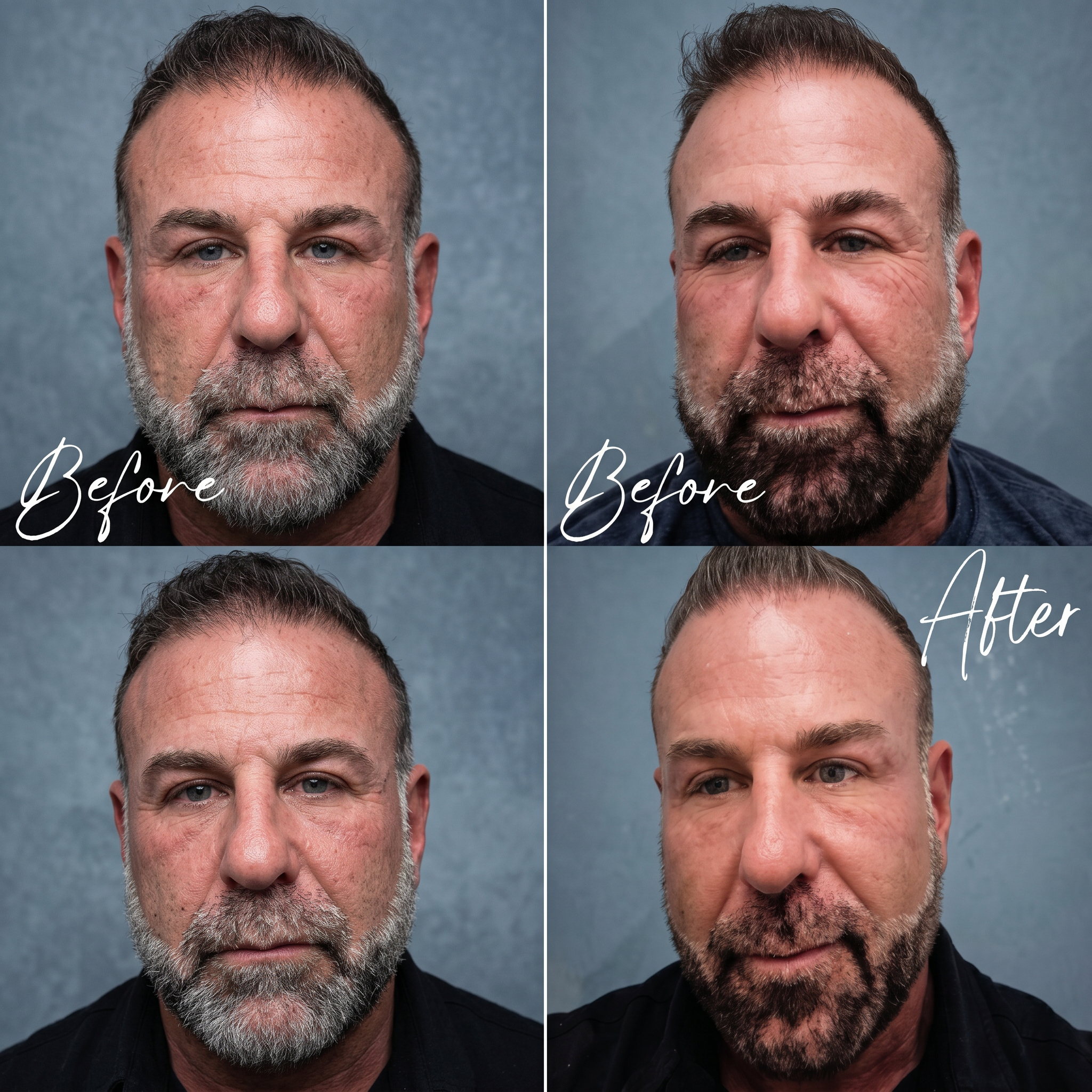 Before and after treatment photo 15