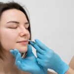 Nasolabial Fold Fillers: What to Know Before Treatment