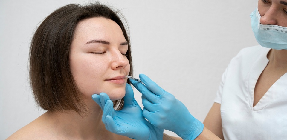 Nasolabial Fold Filler